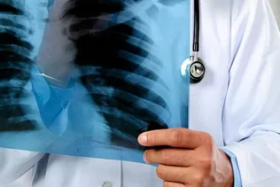 Tüdőszűrés borítóképe